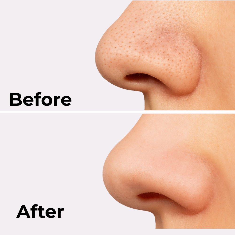 Exfoliating Peel Shot