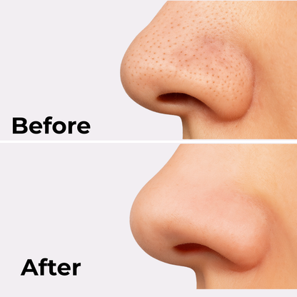 Exfoliating Peel Shot